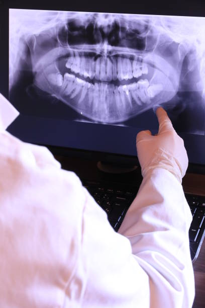 Best Emergency Tooth Extraction in Isle Of Palms, SC
